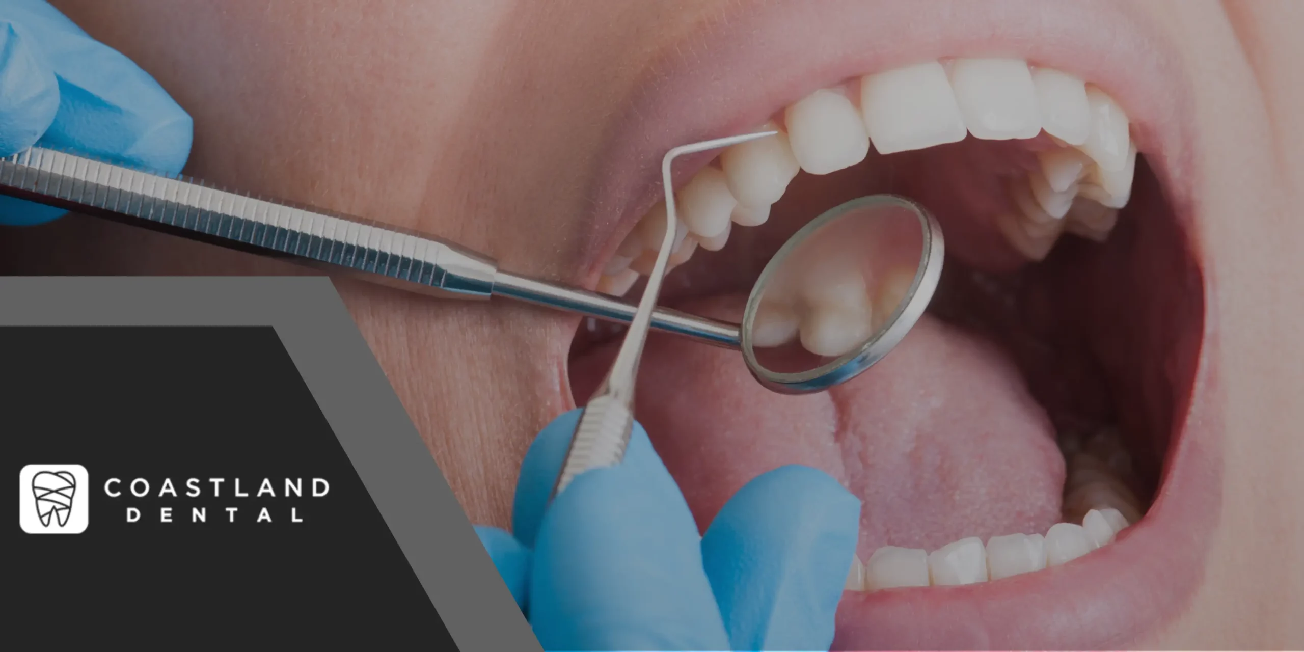 coast dental scaled